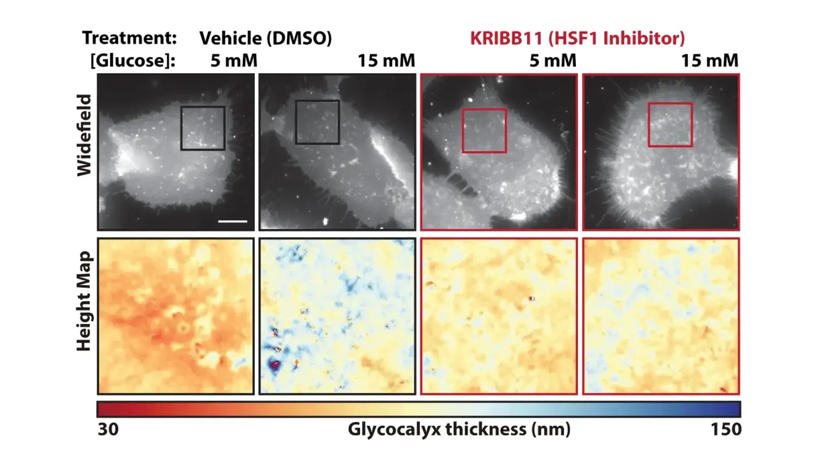 High Blood Sugar Helps Cancer Cells Hide From Immune Cells