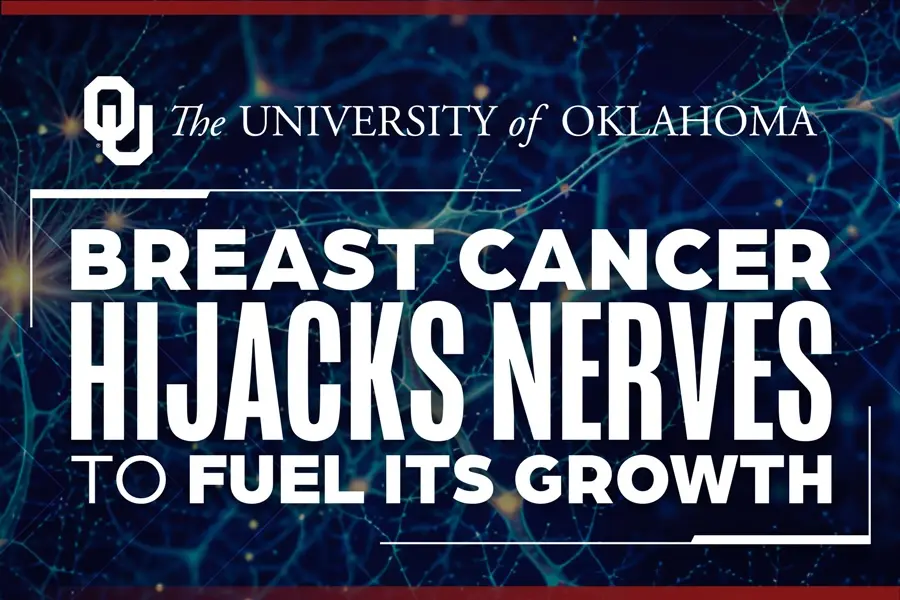 This Breast Cancer Hijacks Immune Cells to Grow Its Own Nerve Supply